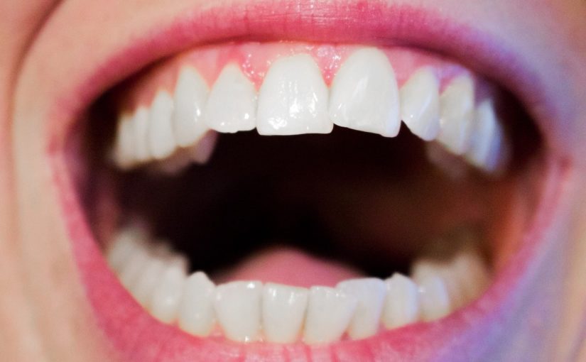 Nowoczesna technika używana w salonach stomatologii estetycznej być może spowodować, że odbierzemy prześliczny uśmiech.
